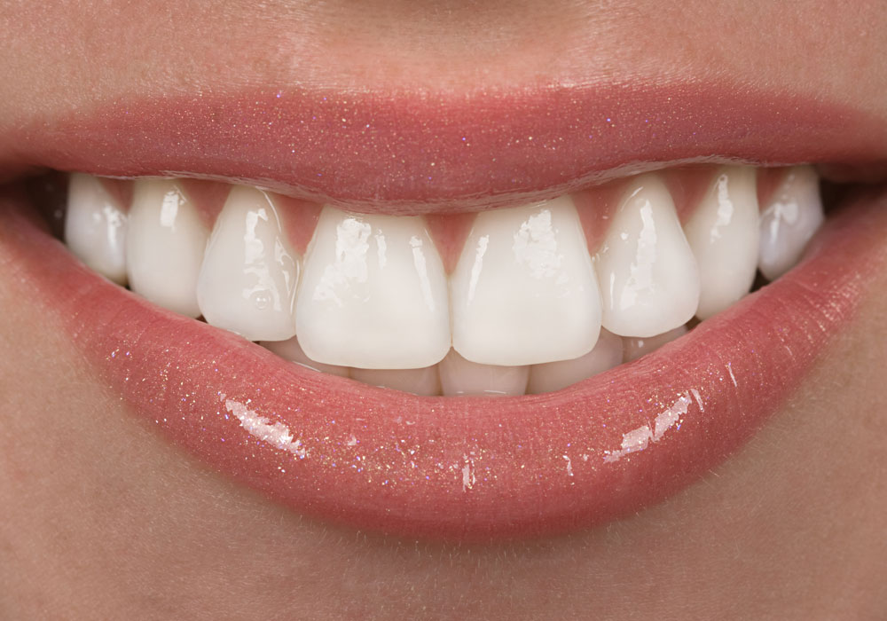 dental patient smiling after porcelain veneers procedure Dana Point CA