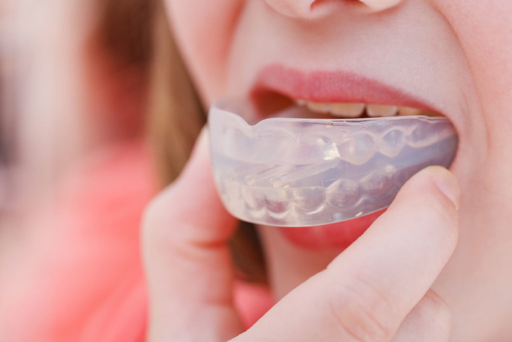 dental patient using mouthguard for tmj treatment Dana Point CA