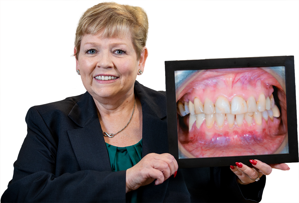 patient smiling after dental procedure Dana Point CA