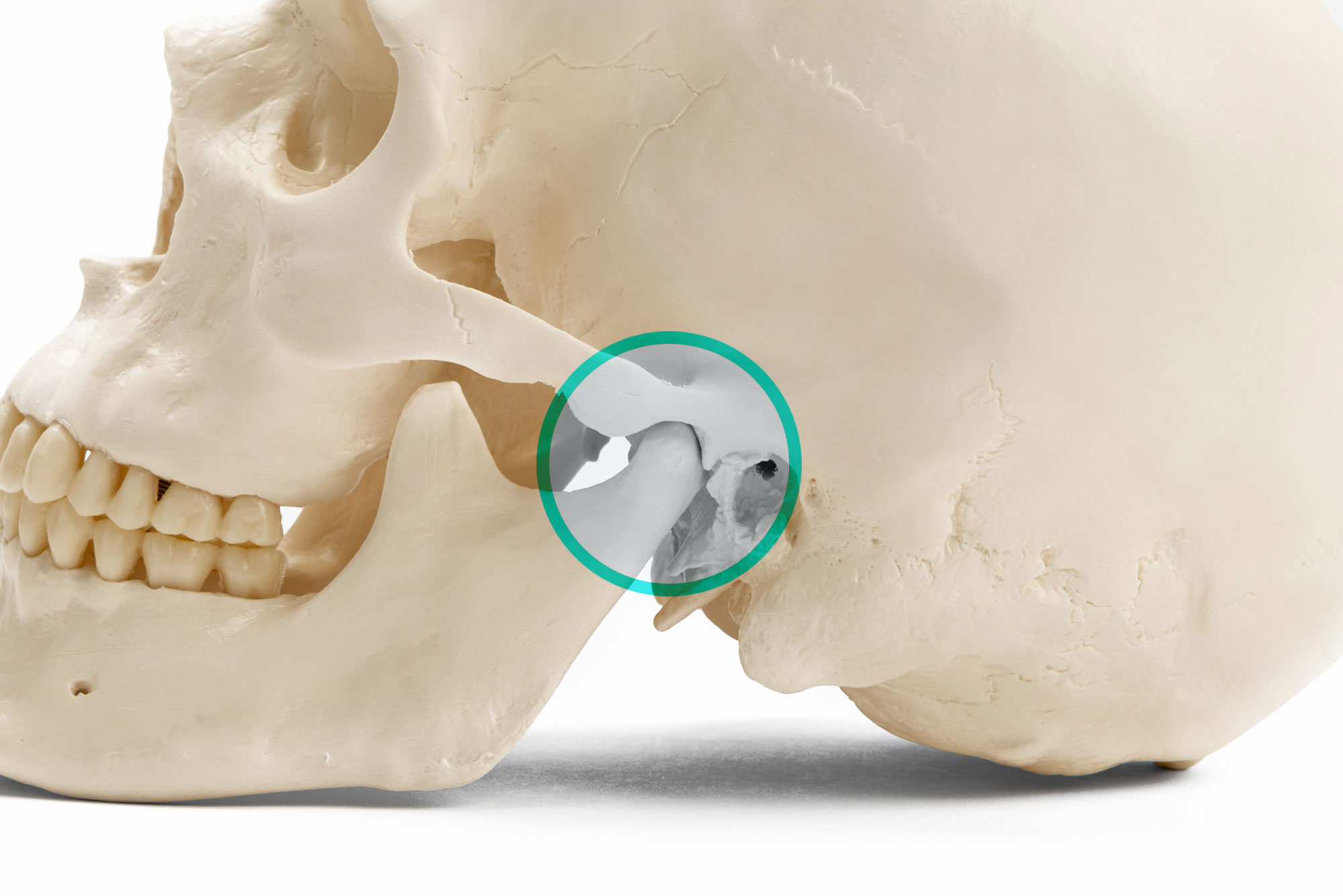 tmj disorder graphic Dana Point CA